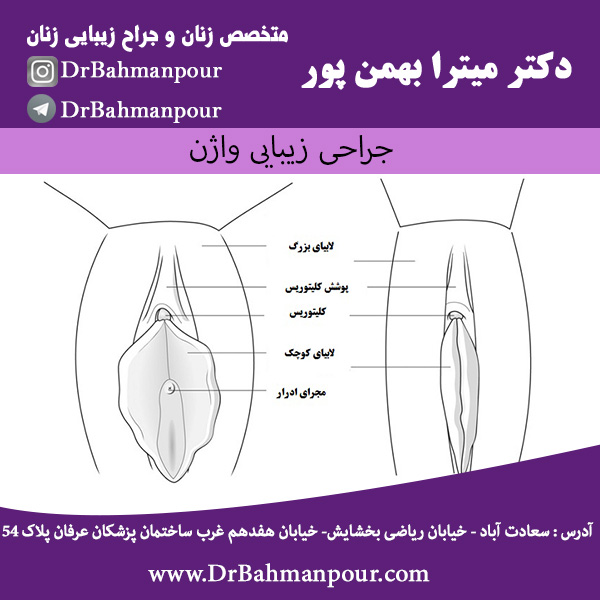 عمل زیبایی ظاهر واژن