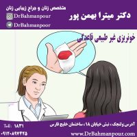 خونریزی غیر طبیعی قاعدگی