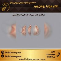 مراقبت های پس از جراحی زیبایی واژن