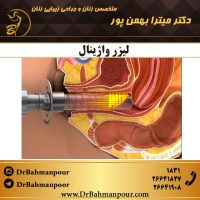 لیزر واژینال