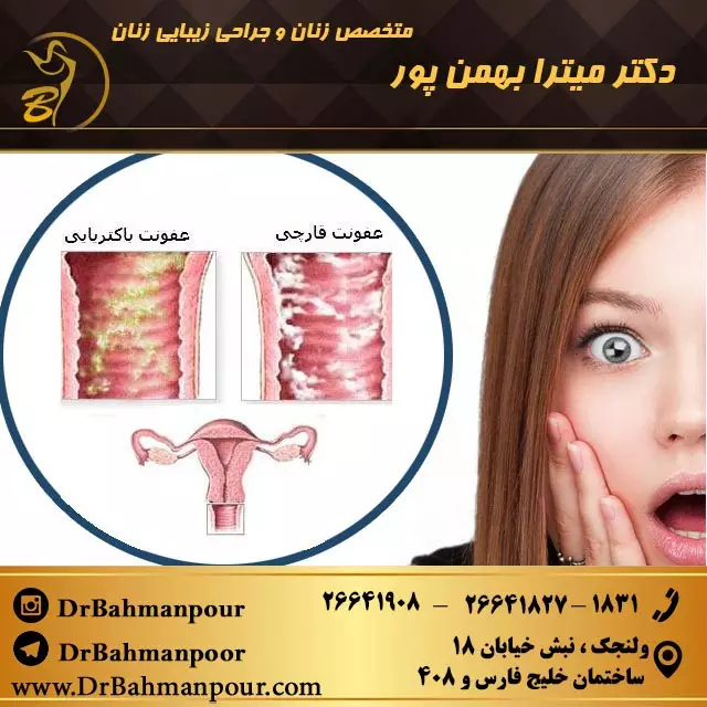 عفونت دستگاه تناسلی