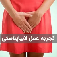 تجربه عمل لابیاپلاستی