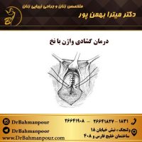 درمان گشادی واژن با نخ