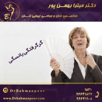 گرگرفتگی یائسگی