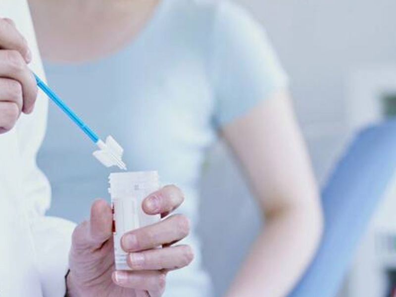 اختبار مسحة عنق الرحم