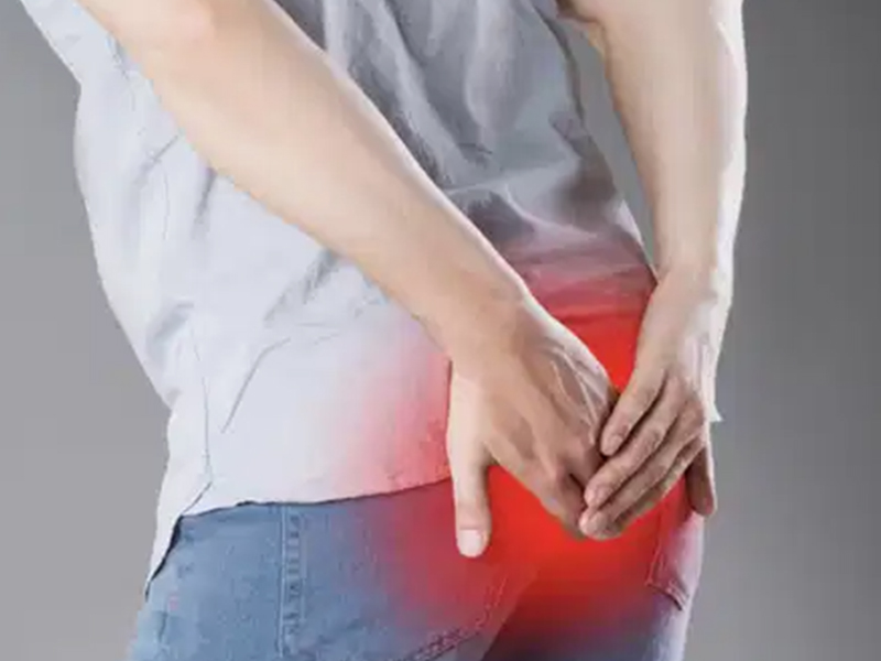 علاج البواسير