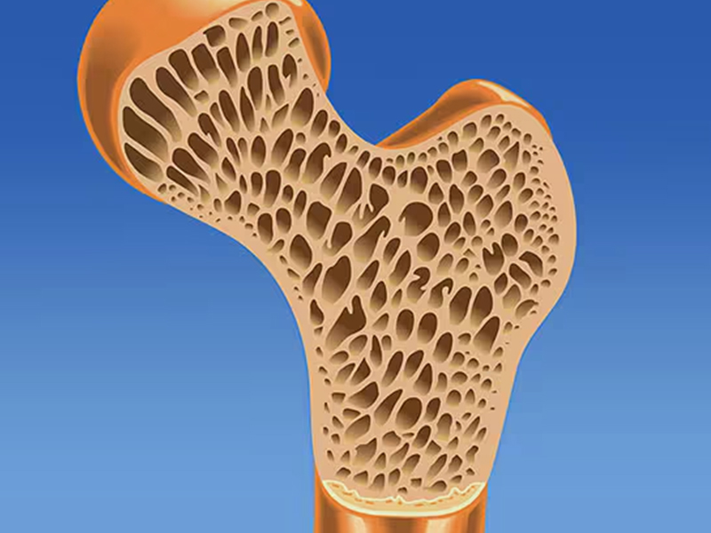 تأثير سن اليأس على هشاشة العظام