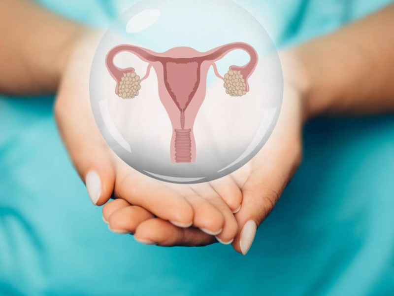 تجاه أي النساء يذهبن كيسات المبيض؟