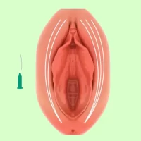 تنگ کردن واژن با نخ